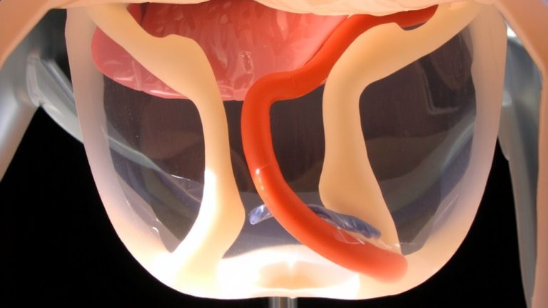 canine portosystemic shunt management