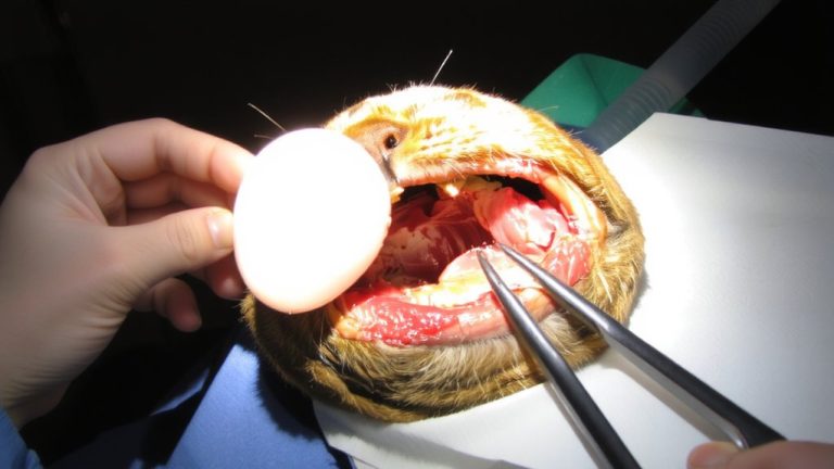 surgical removal of nasopharyngeal polyps